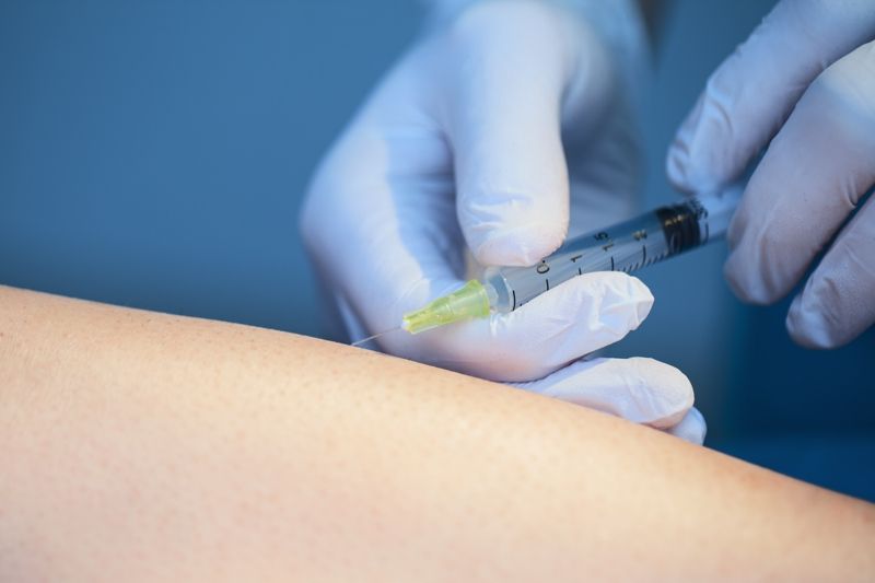 Hidrolipoclasia o Mesoterapia