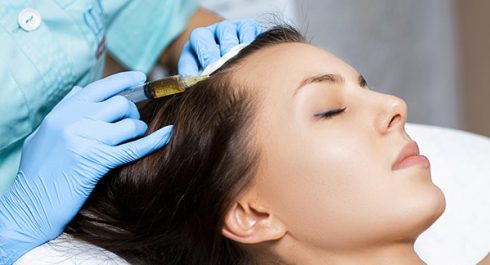¿En qué consiste la mesoterapia capilar?